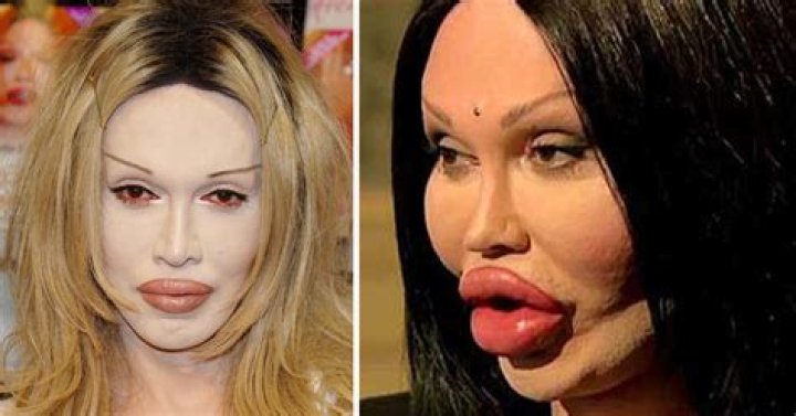 Pete Burns endured over 300 cosmetic surgeries on his face – and it left the singer bankrupt